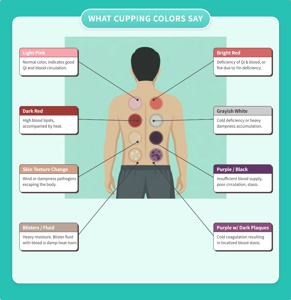 Cupping Color Chart and meaning